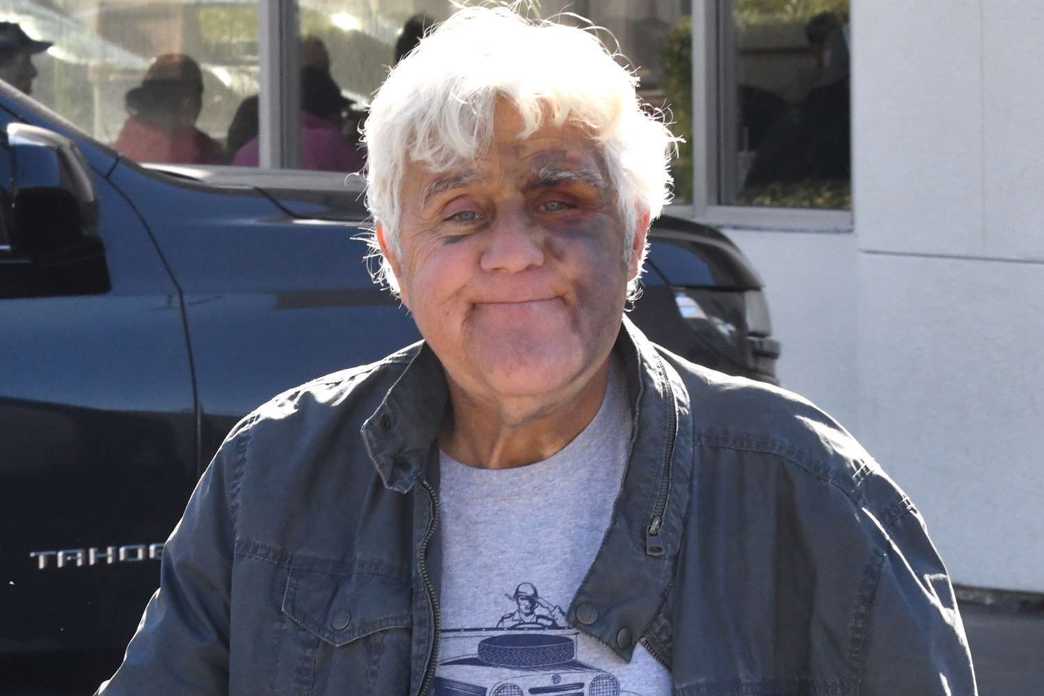 Jay Leno Steps Out in Las Vegas Despite Terrible Fall