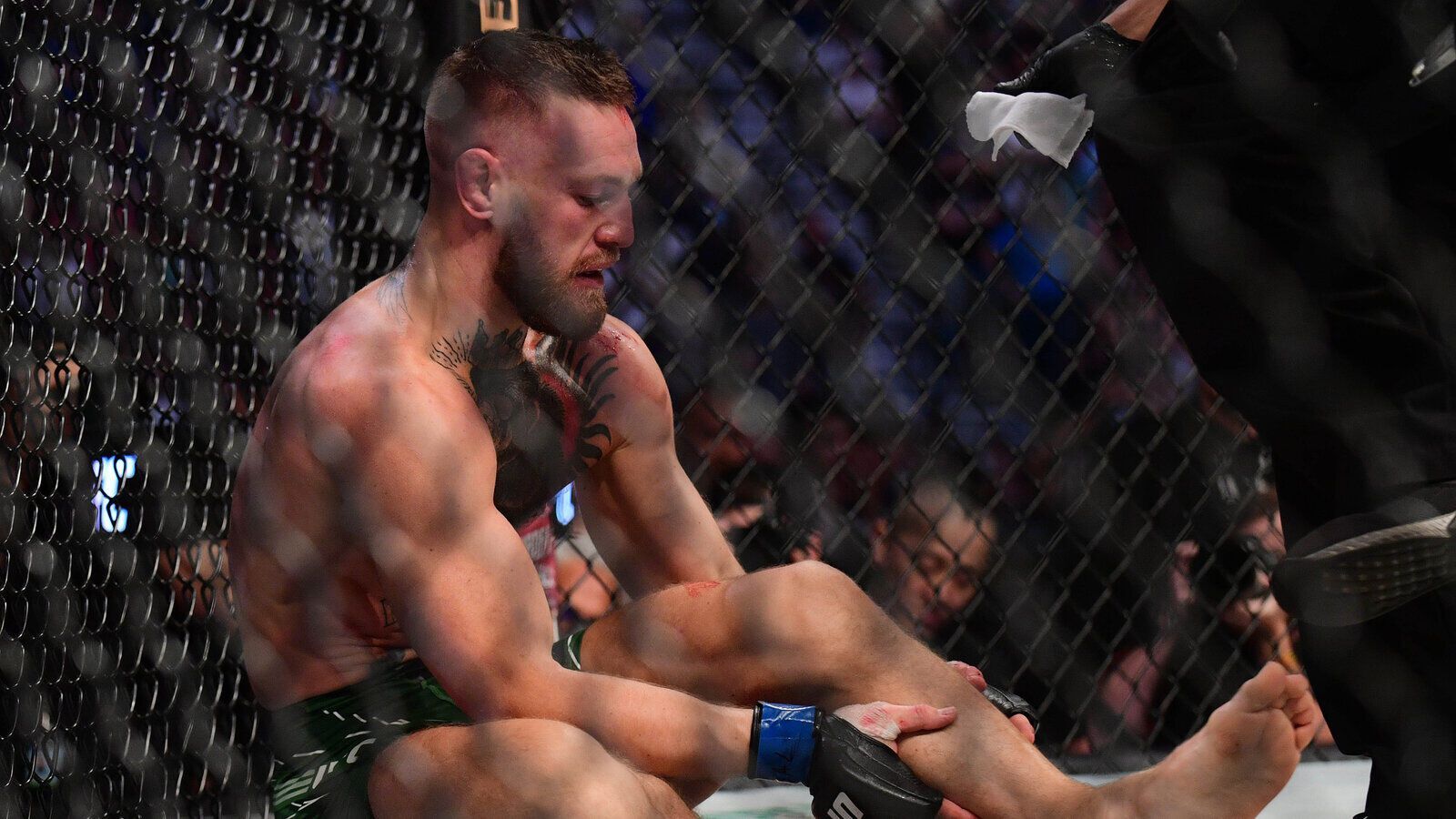 Conor McGregor broke his leg in 2021