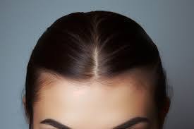 Widow’s Peak: Unraveling the Spiritual Significance of a Unique Hairline