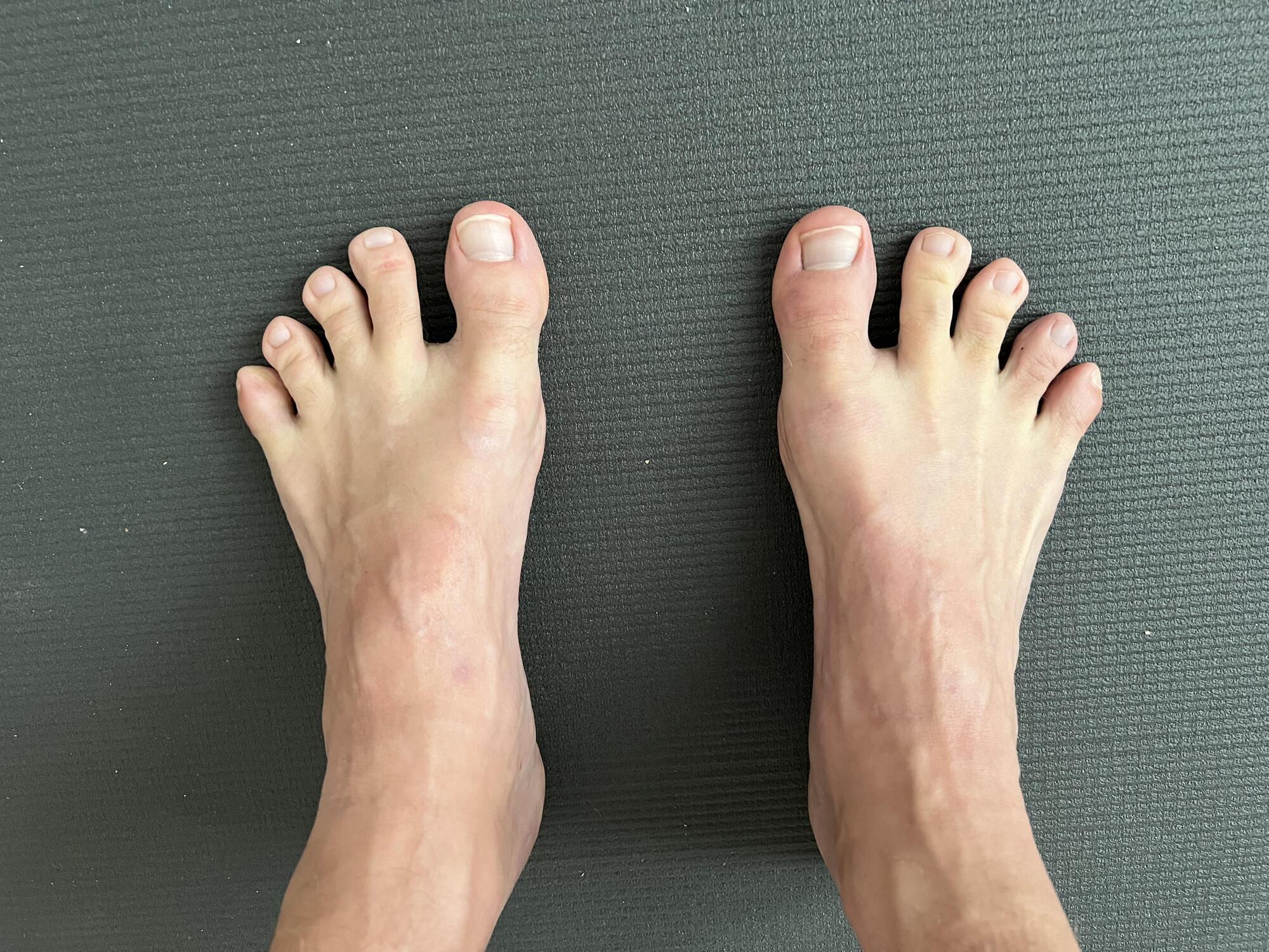 What Does Your Toe Length Reveal About You? A Closer Look