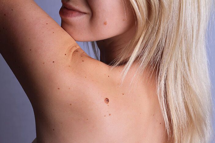 Spiritual Meanings of Beauty Marks Explained