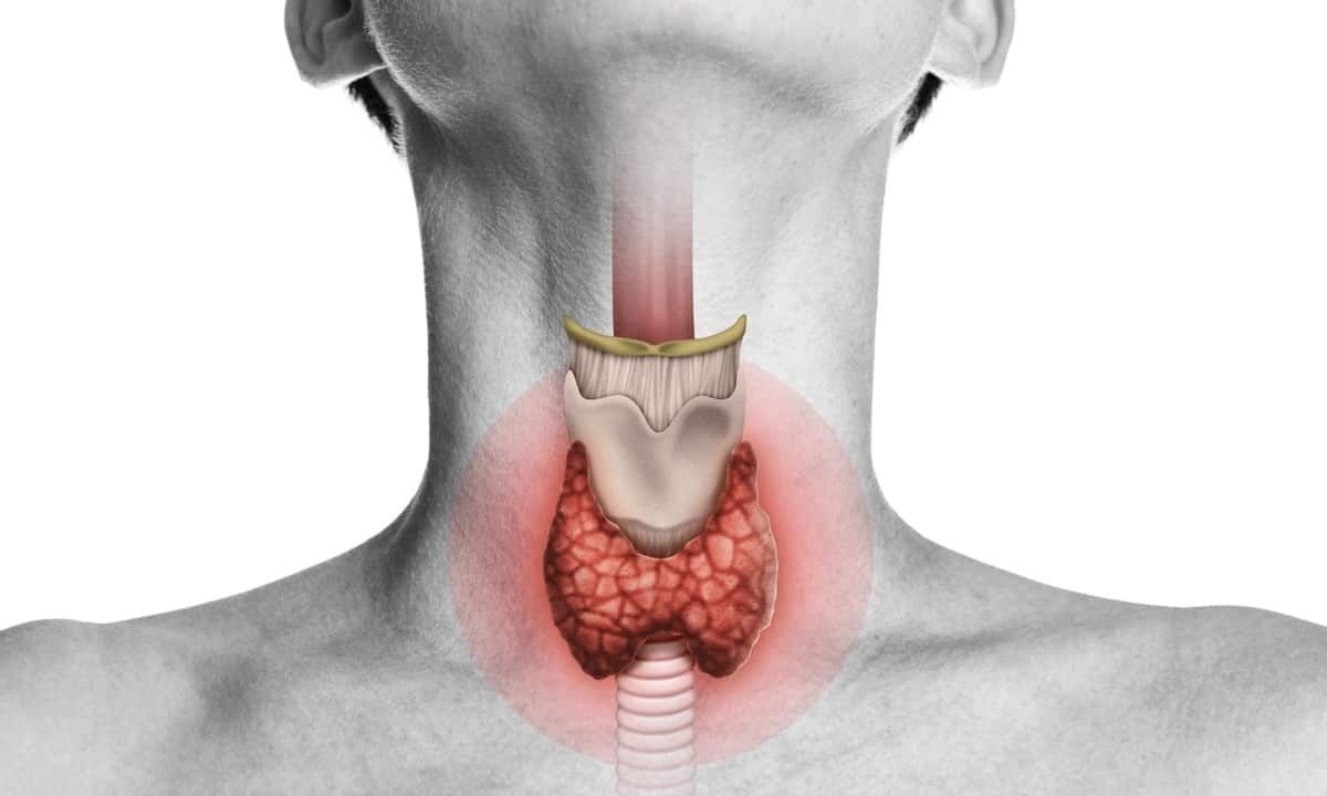 Thyroid problems