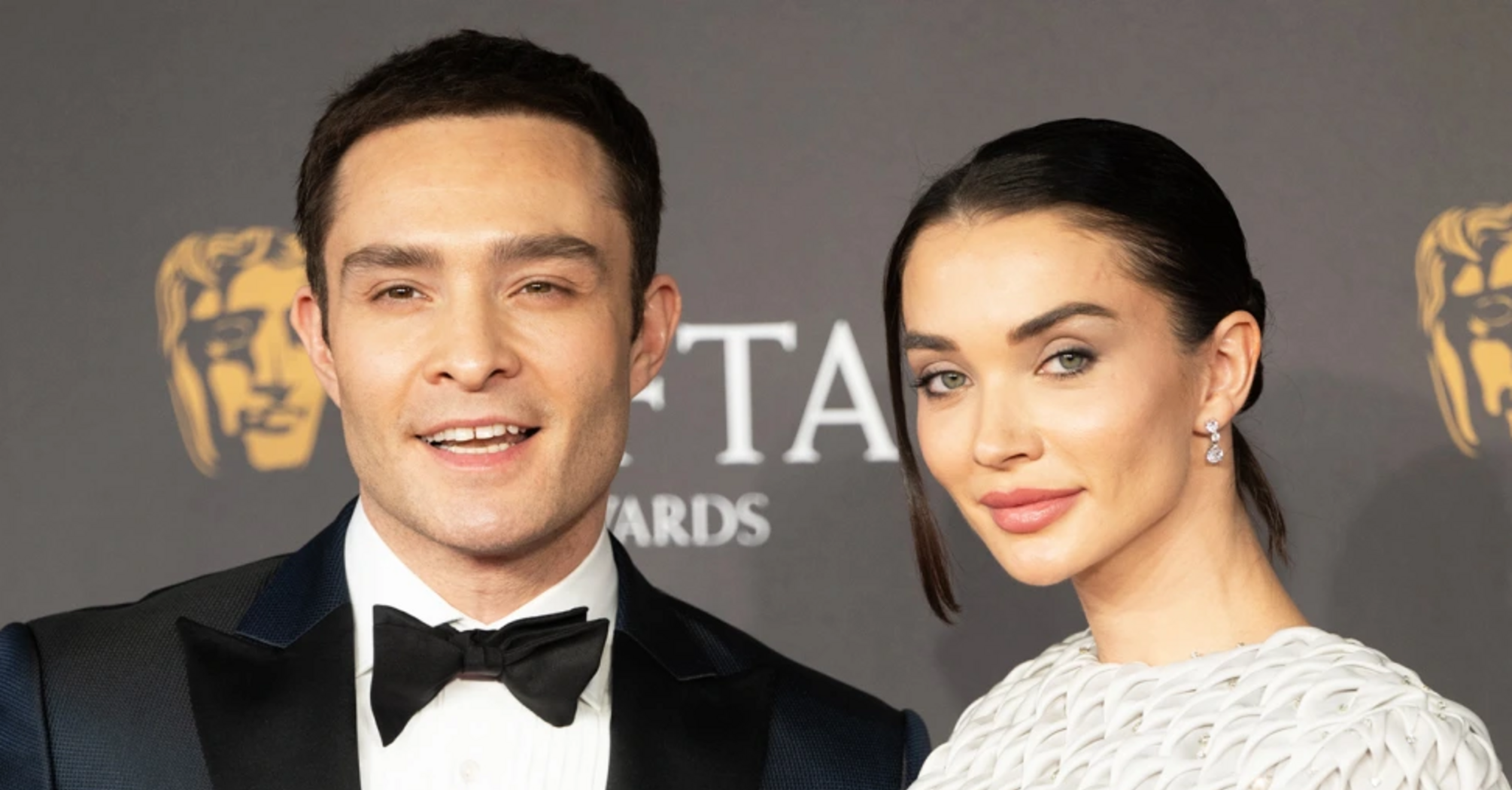 Ed Westwick and Amy Jackson Expecting Their First Child Amidst Recent Italian Marriage