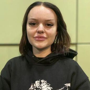 Woman Develops Geordie Accent After Migraine