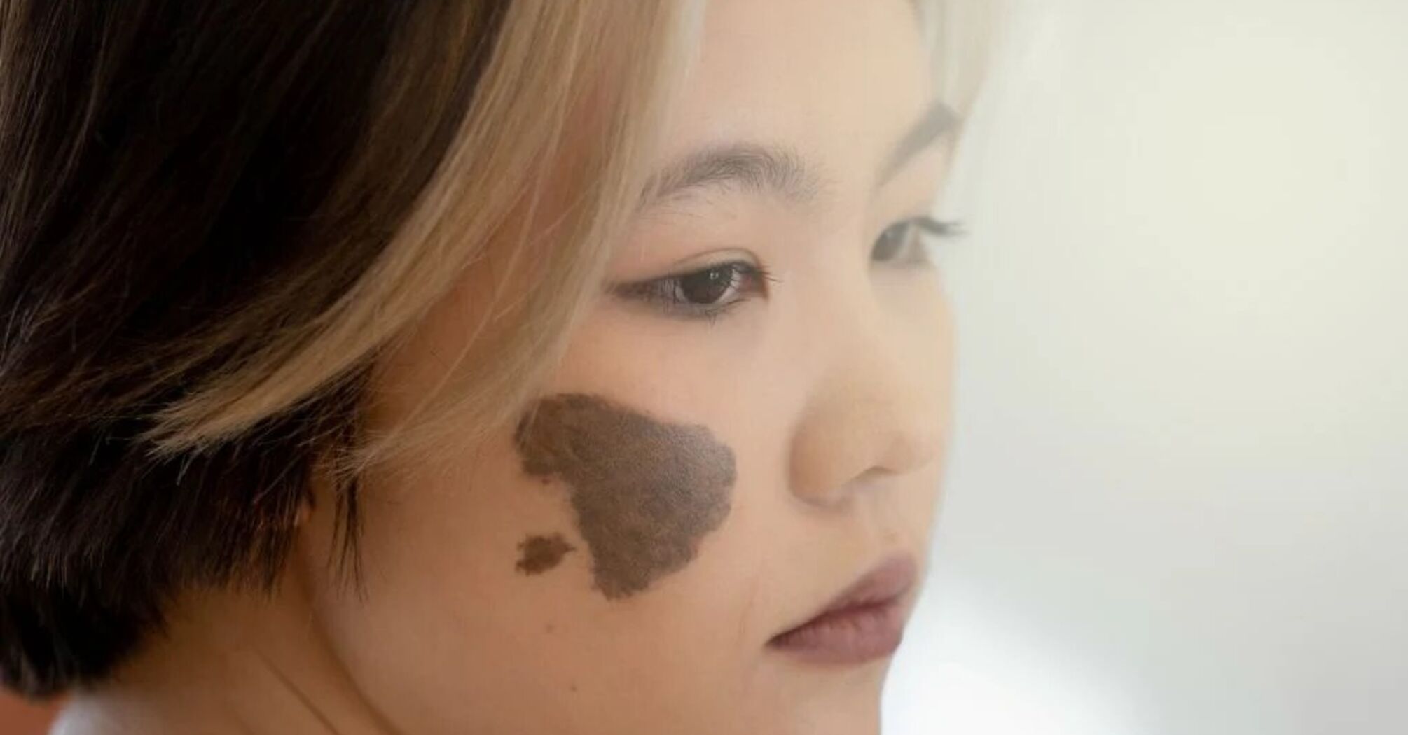 Bailey R Birthmark Interpretation of Birthmarks: Spiritual Significance | SSP Daily