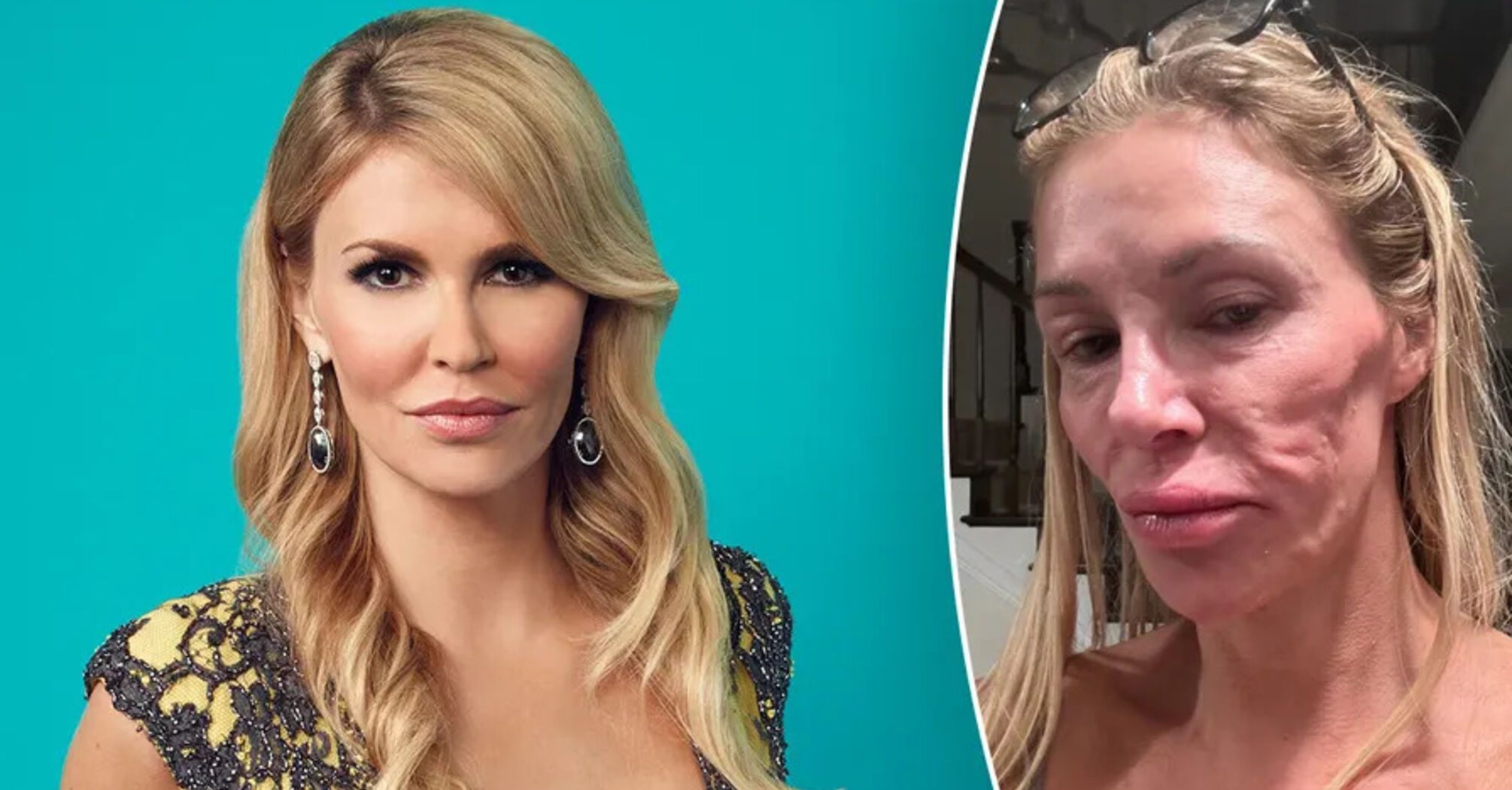  Brandi Glanville Addresses Health Concerns with Dr. Terry Dubrow