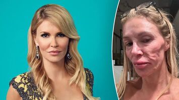 Brandi Glanville Addresses Health Concerns with Dr. Terry Dubrow