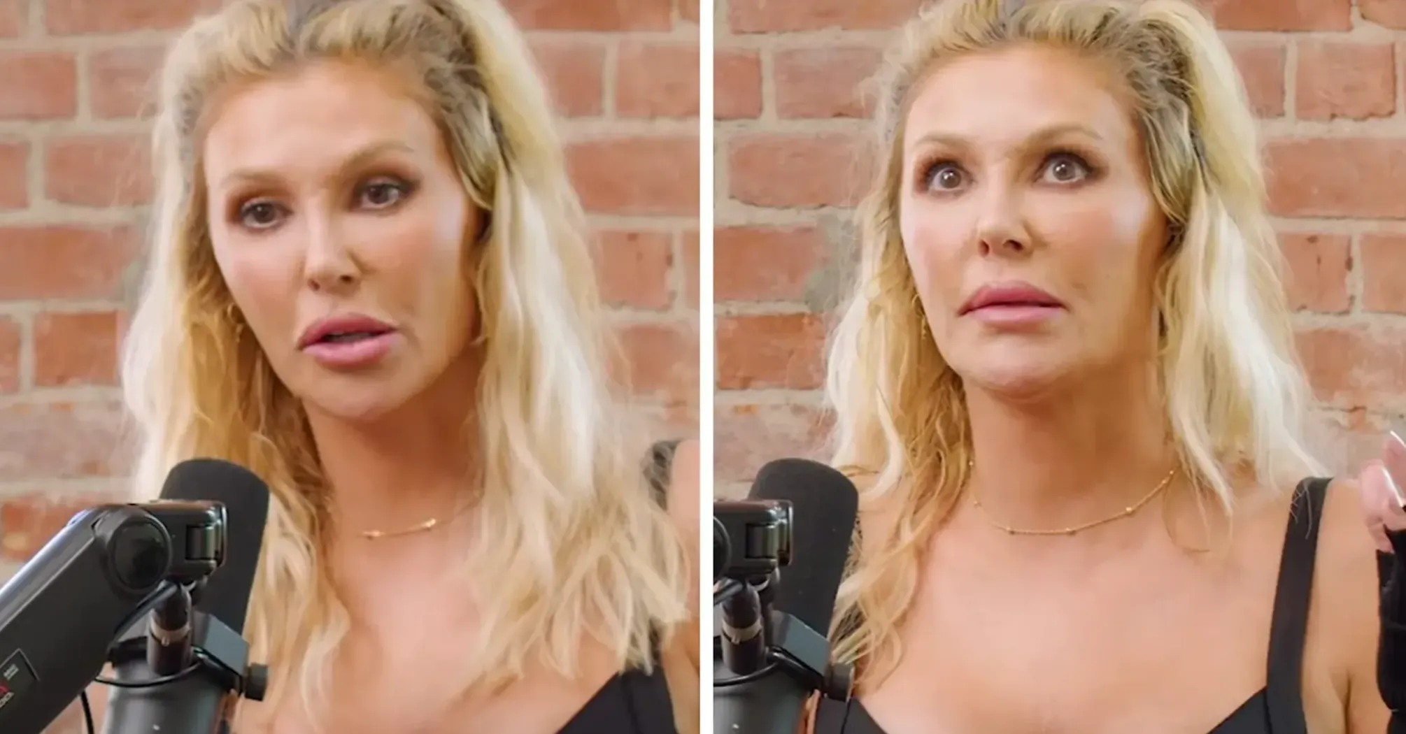 Brandi Glanville Addresses the Impact of Facial Deformity on Her Life