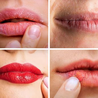 How to properly care for your lips