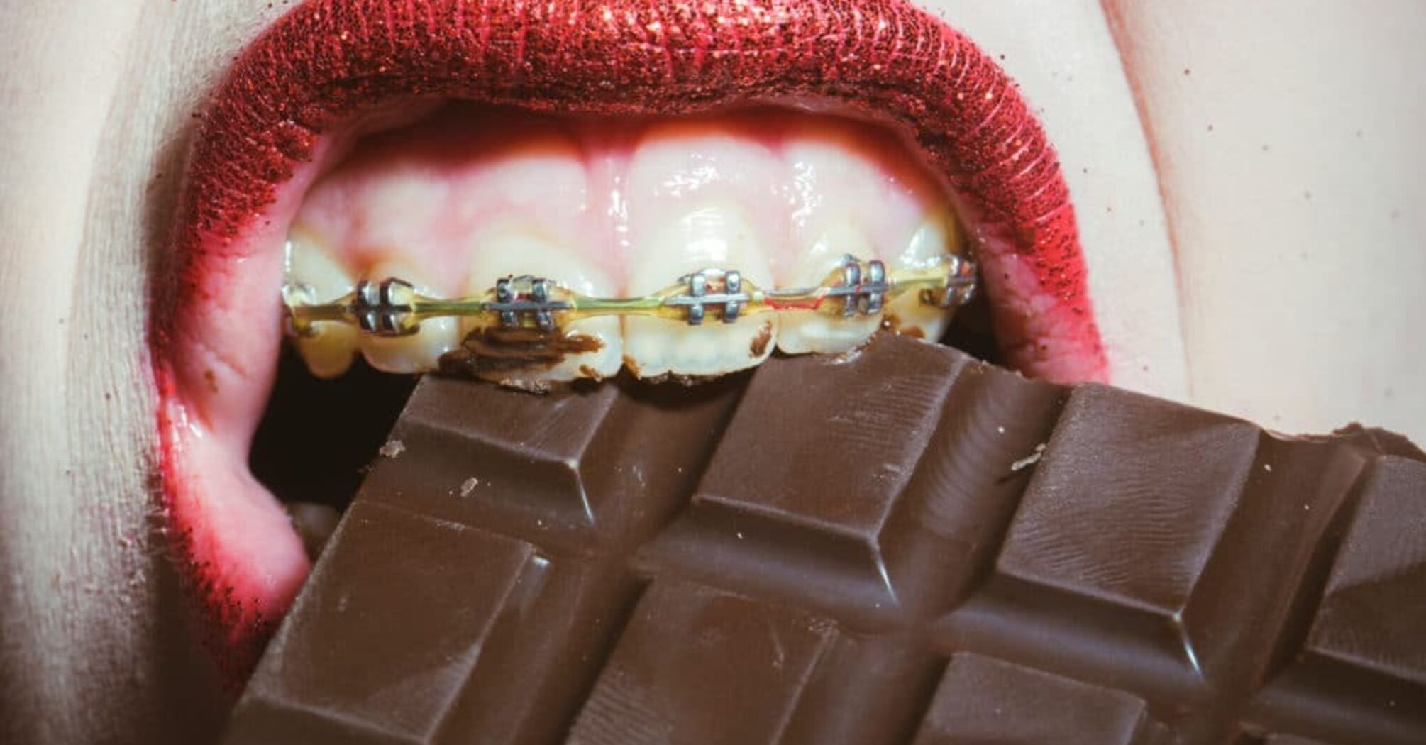 What you can and cannot eat with braces
