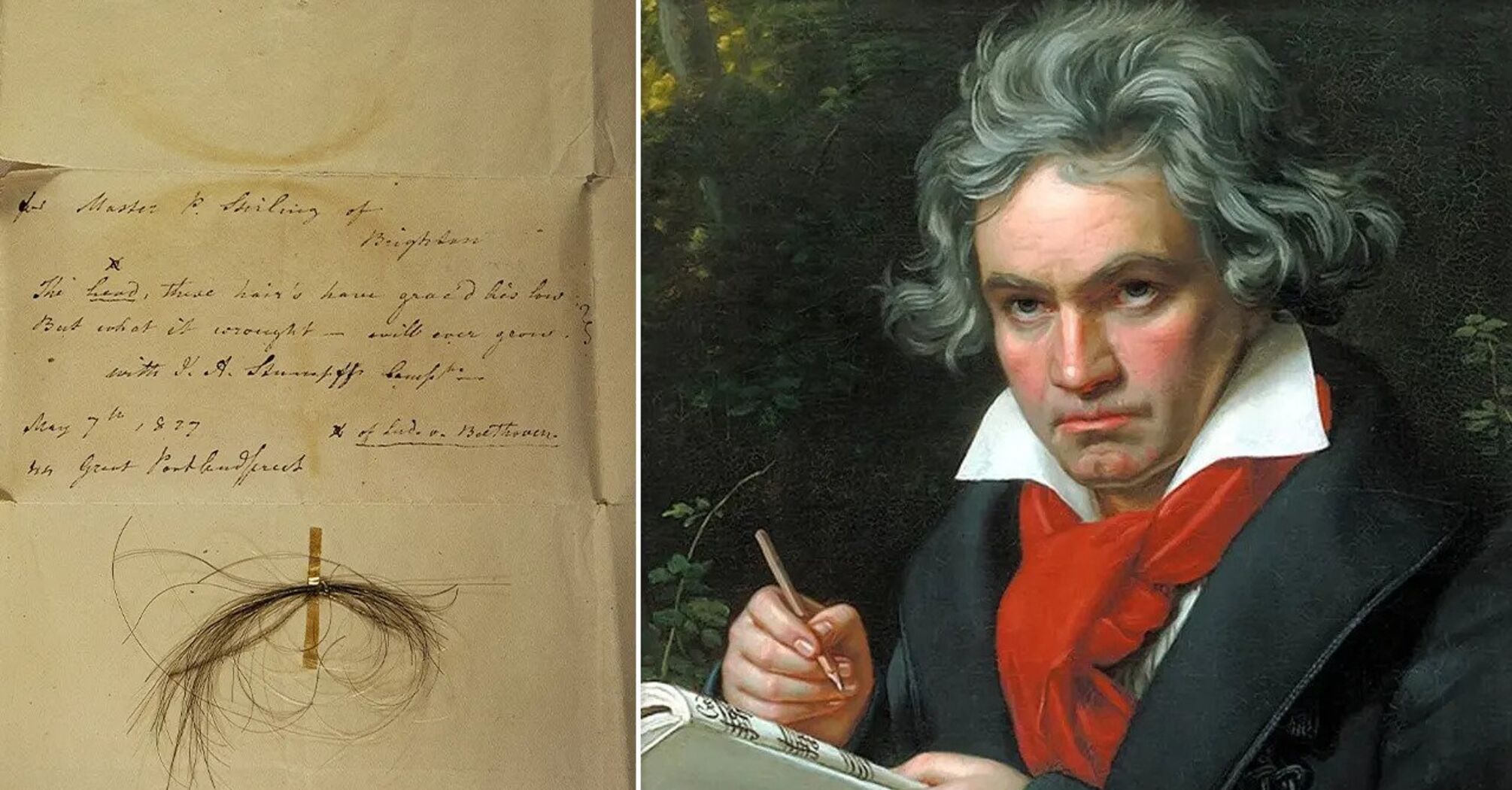 Primary cause of Beethoven's death