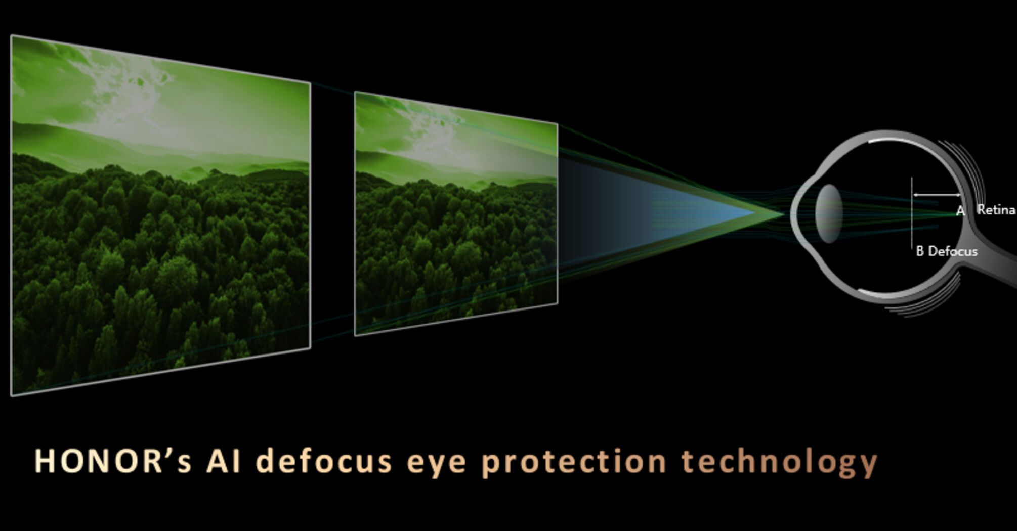  AI-Powered Defocus Eye Protection
