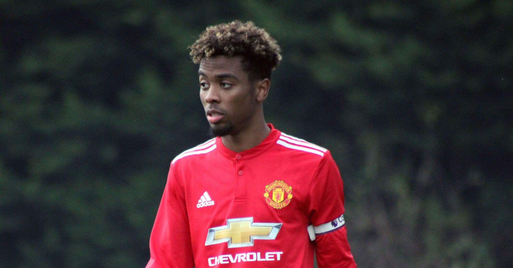 Lille's Angel Gomes Hospitalized After Head Injury During Match With Reims