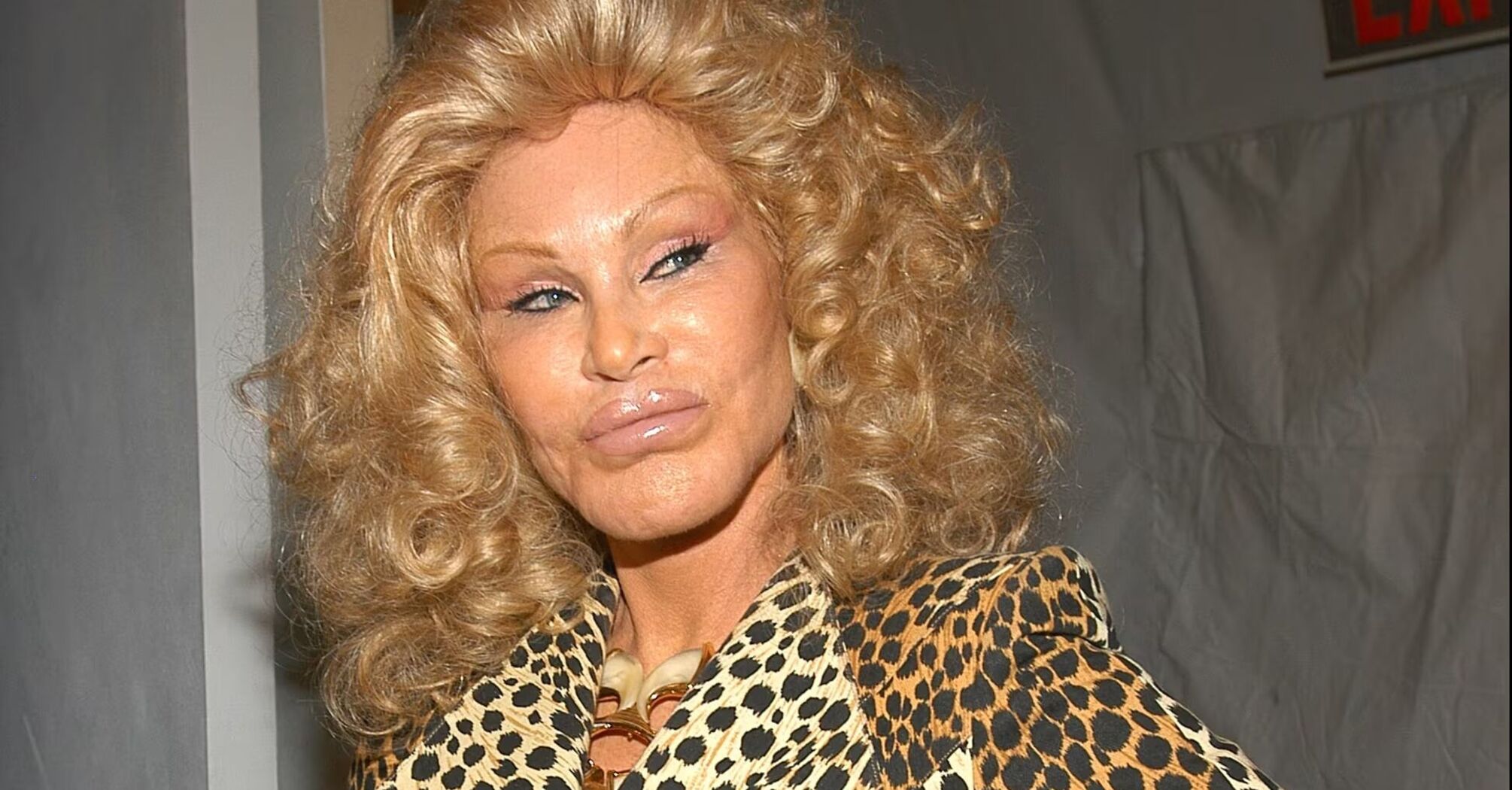  Jocelyn Wildenstein