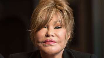 Socialite Known as ‘Catwoman’ Jocelyn Wildenstein’s Cause of Death Presumed to Be Phlebitis