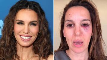 Christy Carlson Romano Hospitalized After Eye Injury